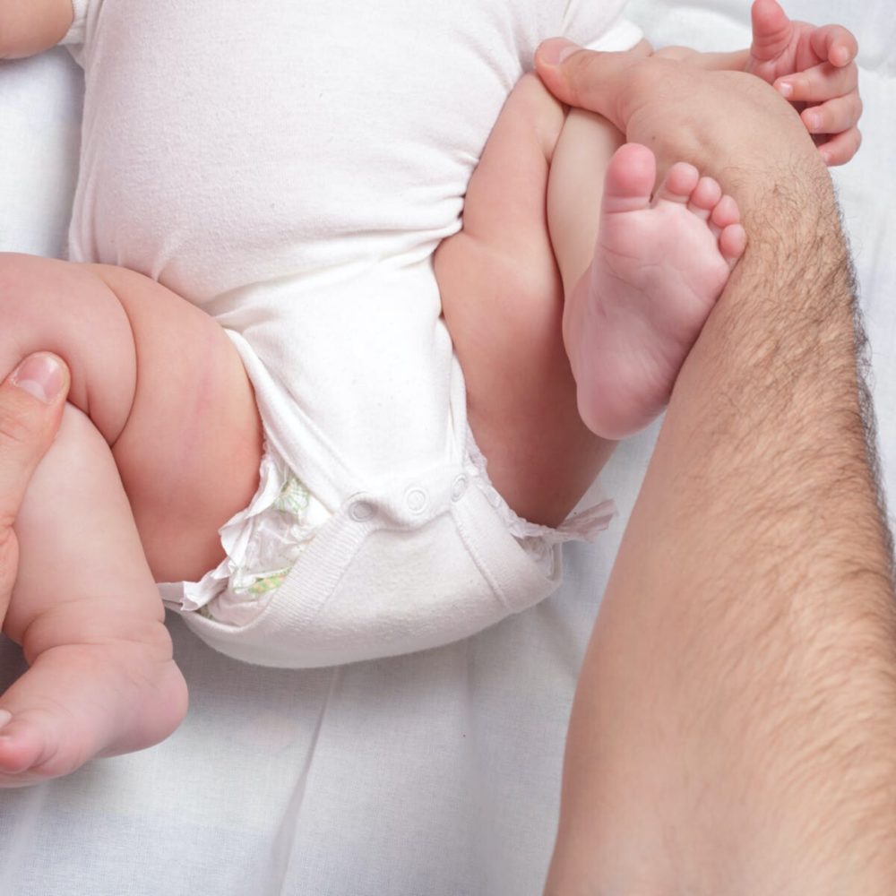 hip dysplasia Archives Western Paediatric Physiotherapy